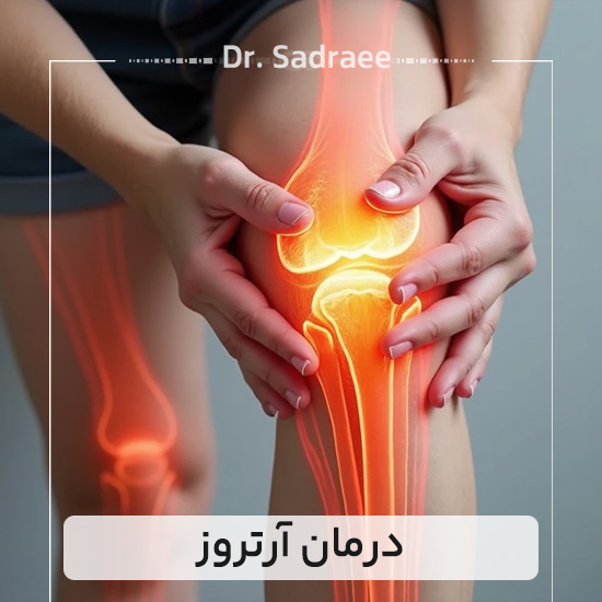 درمان آرتروز